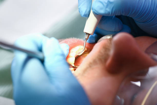Best Emergency Denture Repair in Lake Belvedere Estates, FL