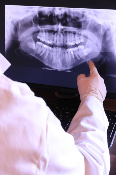 Best Emergency Dental Care for Broken or Chipped Teeth in Lake Belvedere Estates, FL